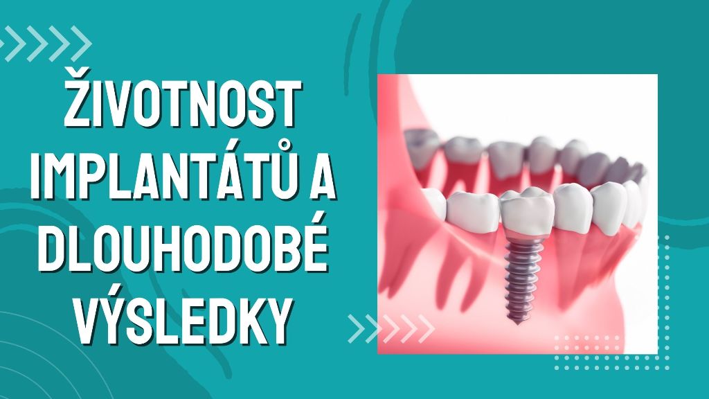 Životnost Implantátů a Dlouhodobé Výsledky