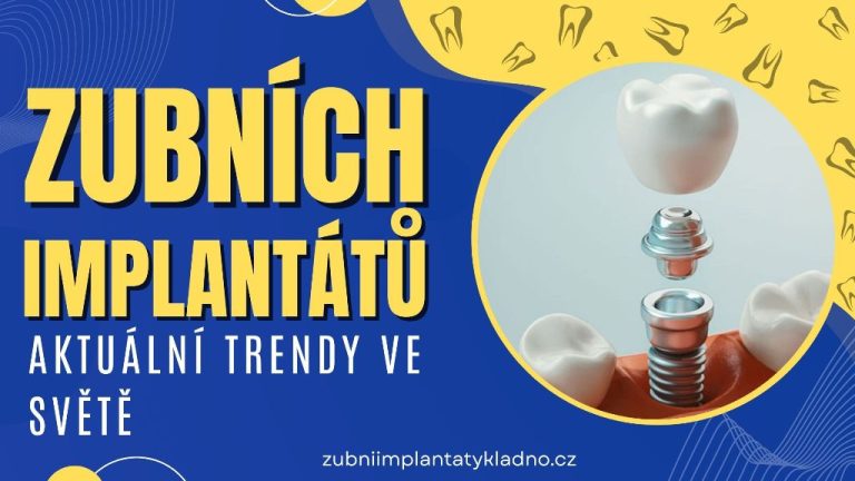 Aktuální trendy ve světě zubních implantátů