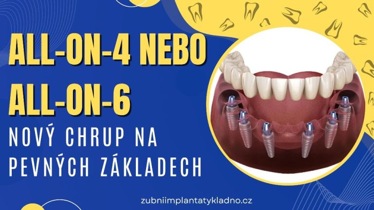 All-on-4 nebo All-on-6_ Nový chrup na pevných základech