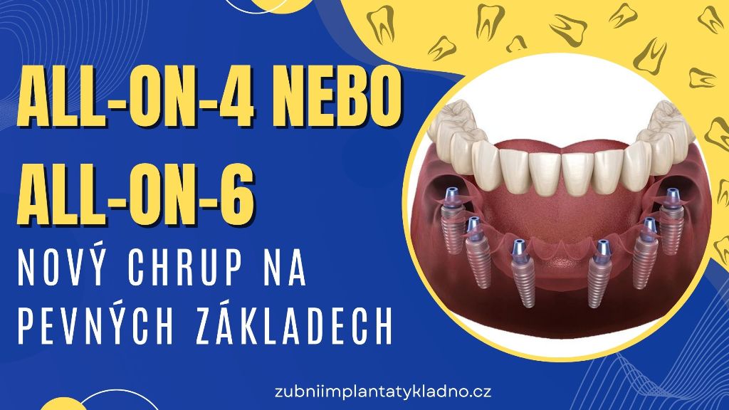 All-on-4 nebo All-on-6_ Nový chrup na pevných základech