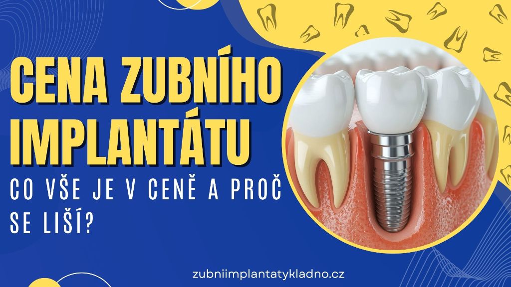 Cena zubního implantátu_ Co vše je v ceně a proč se liší