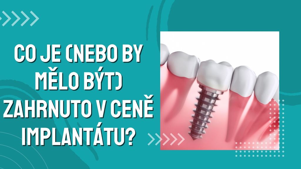 Co je (nebo by mělo být) zahrnuto v ceně implantátu