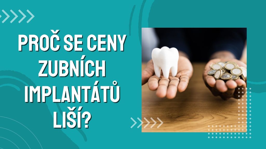 Proč se ceny zubních implantátů liší