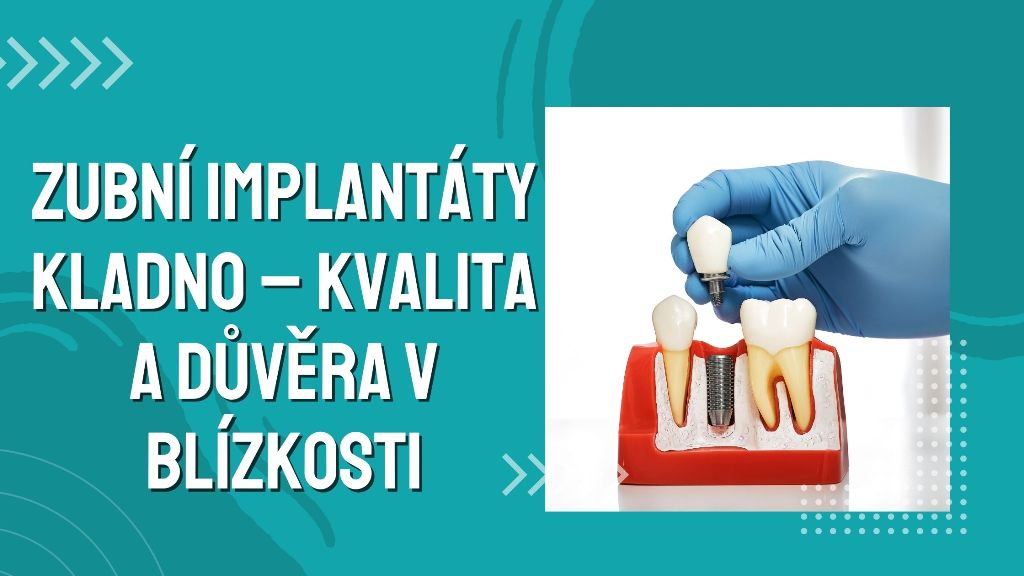Zubní implantáty Kladno – kvalita a důvěra v blízkosti