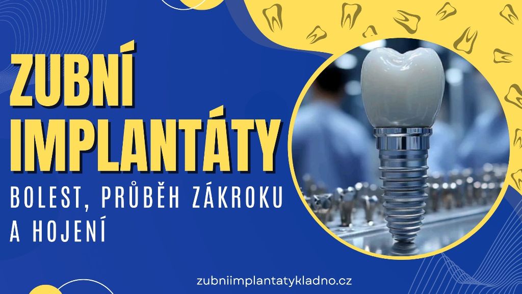 Zubní implantáty – bolest, průběh zákroku a hojení