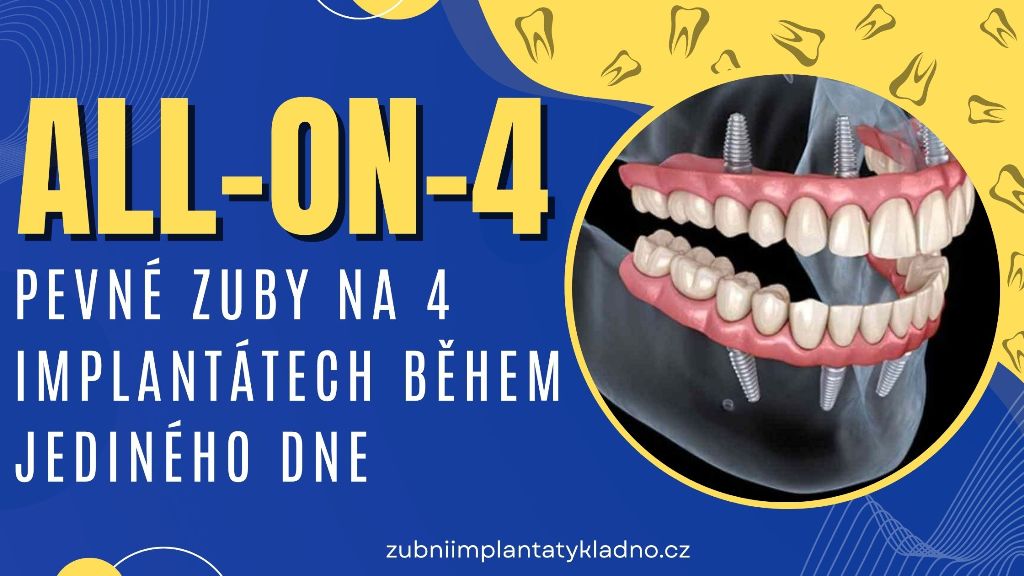 All-on-4_ Pevné zuby na 4 implantátech během jediného dne